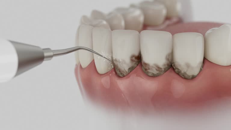 Trusted Dental Crowns And Bridges service in Refugio, TX - Dentist Open Now
